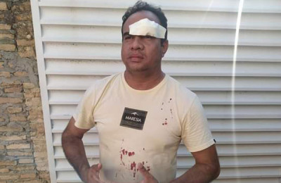 Jornalista é assaltado e agredido, na porta de casa, em Barras-PI