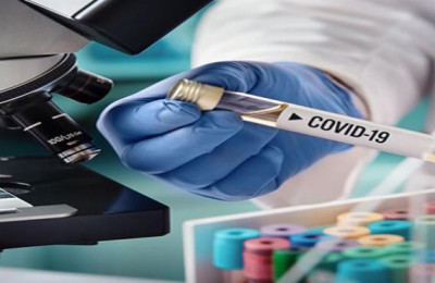 Cerca de 52% dos testes para COVID-19 têm resultado positivo em Teresina