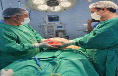 Médicos retiram cisto de 5 quilos de mulher em Bom Jesus-PI