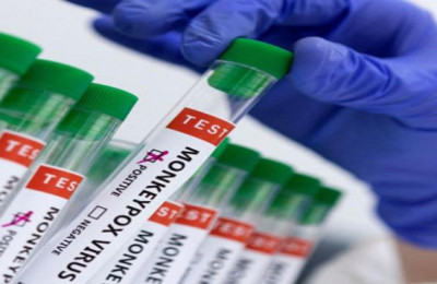 Secretaria de Saúde confirma o 1º caso de varíola dos macacos no PI