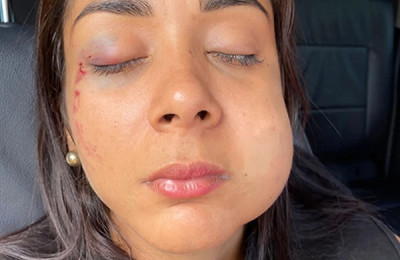 Mulher é espancada com socos no rosto e desmaia após discussão em Teresina